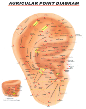 Auricular Medicine
