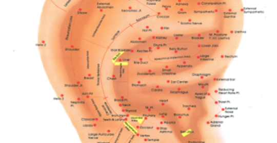 Auricular Therapy